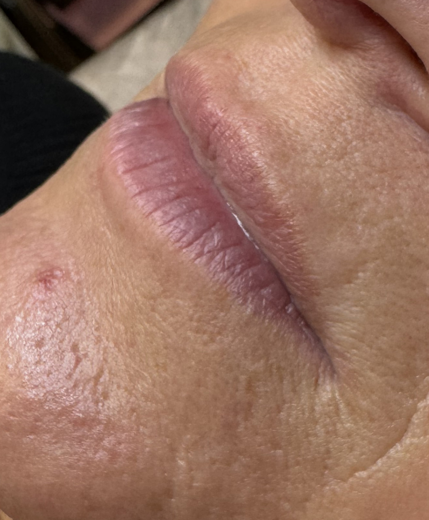 Before Image: Lip Blushing - left-front-oblique