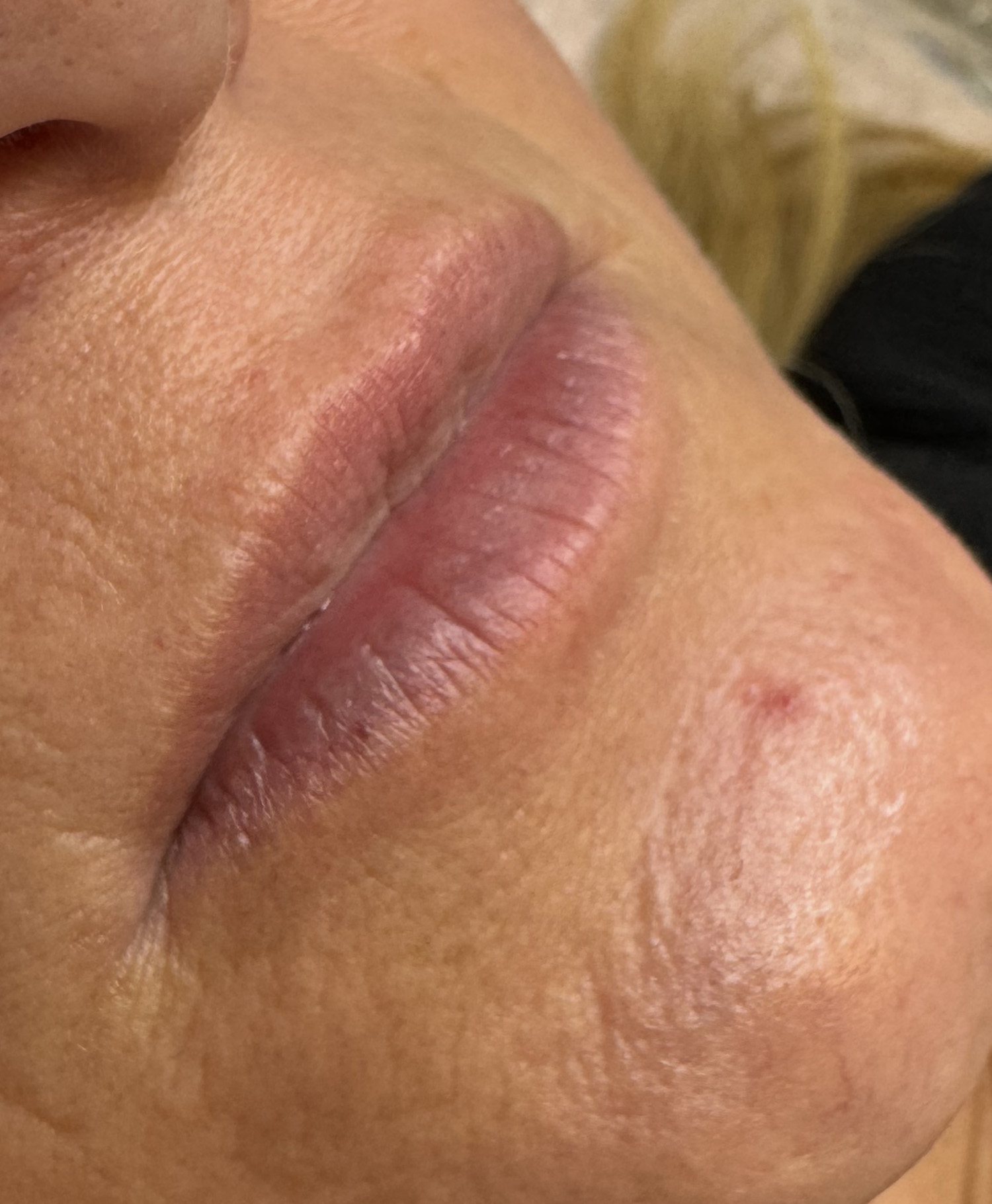 Before Image: Lip Blushing - right-front-oblique