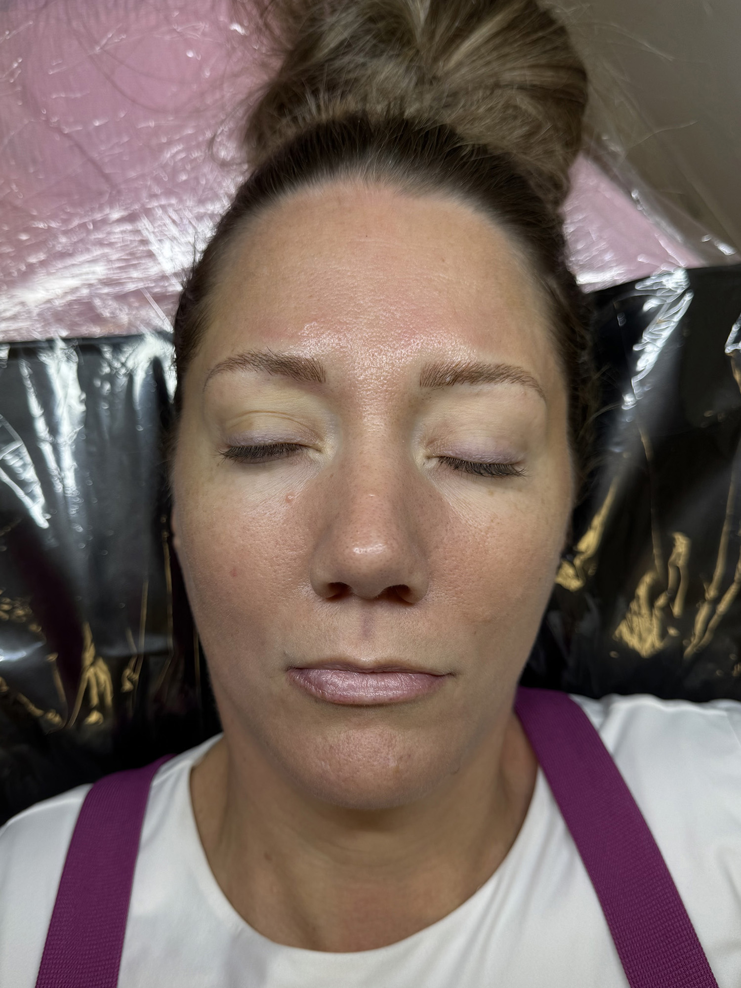 After Image: Microblading - front