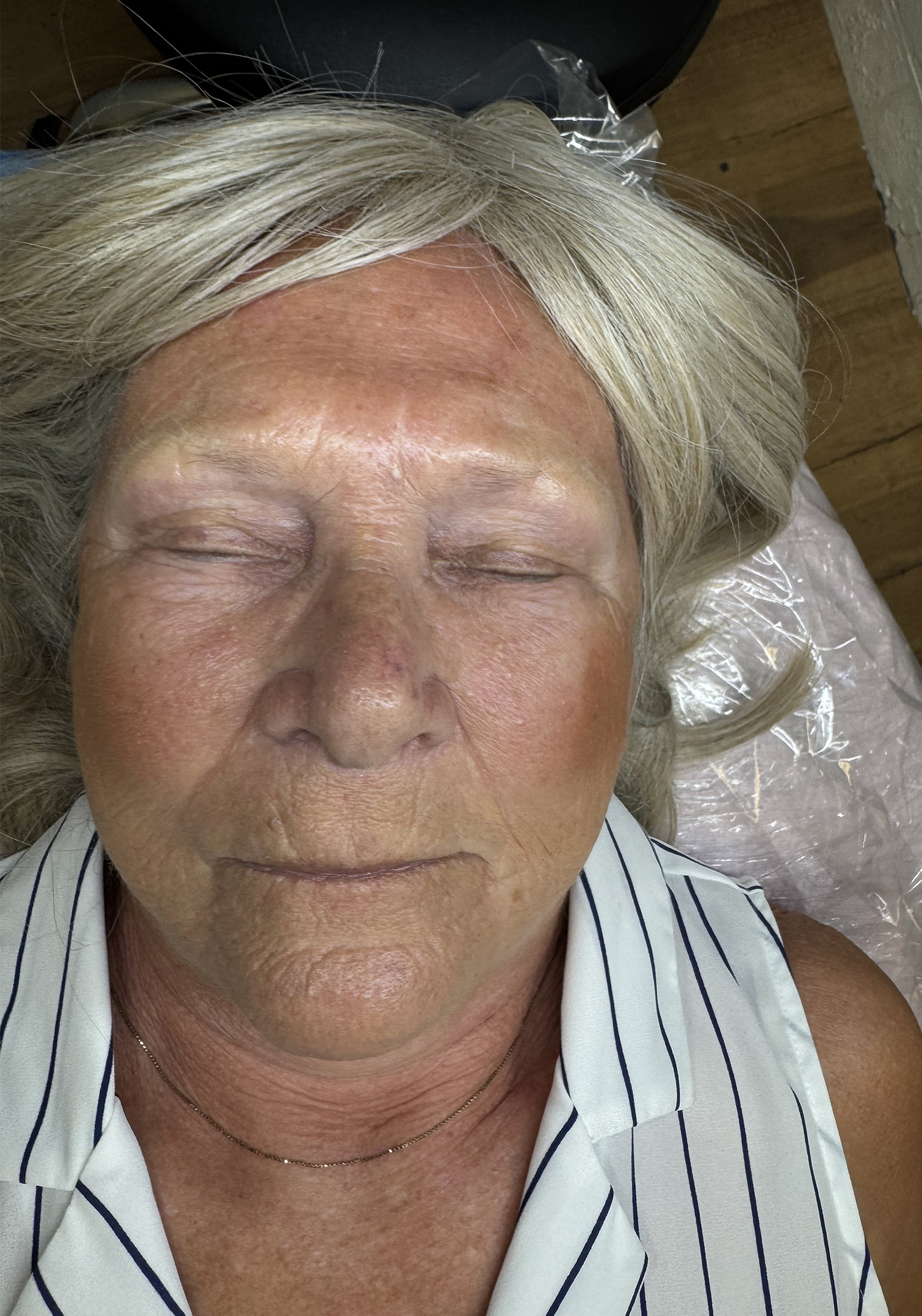 Before Image: Nano Brows - front