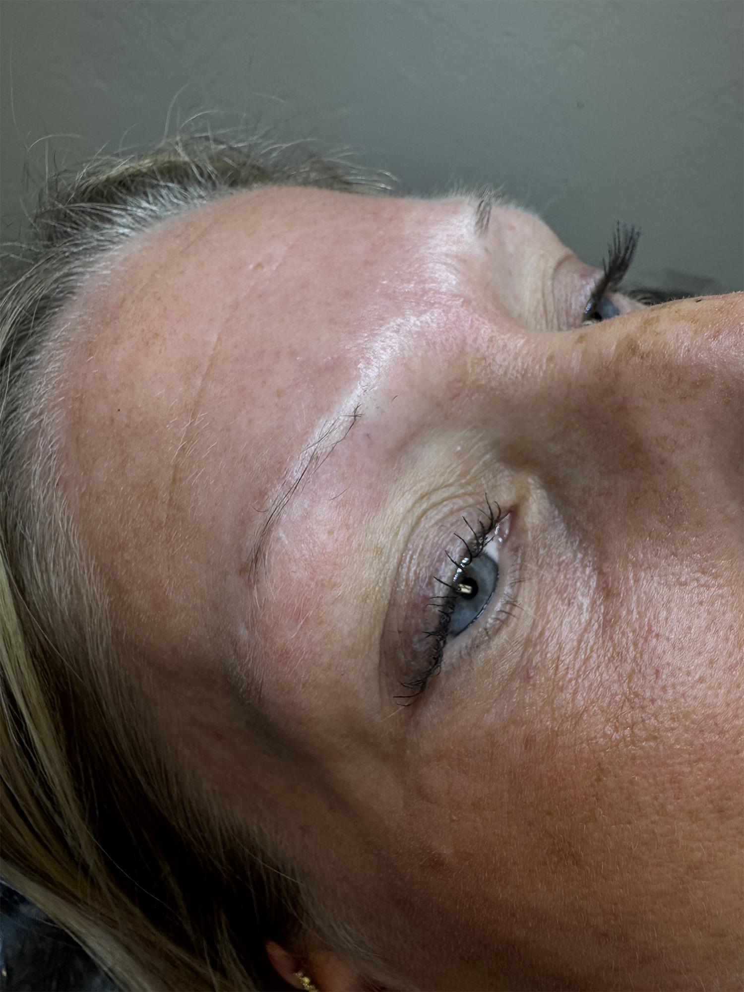 Before Image: Nano Brows - right-front-oblique
