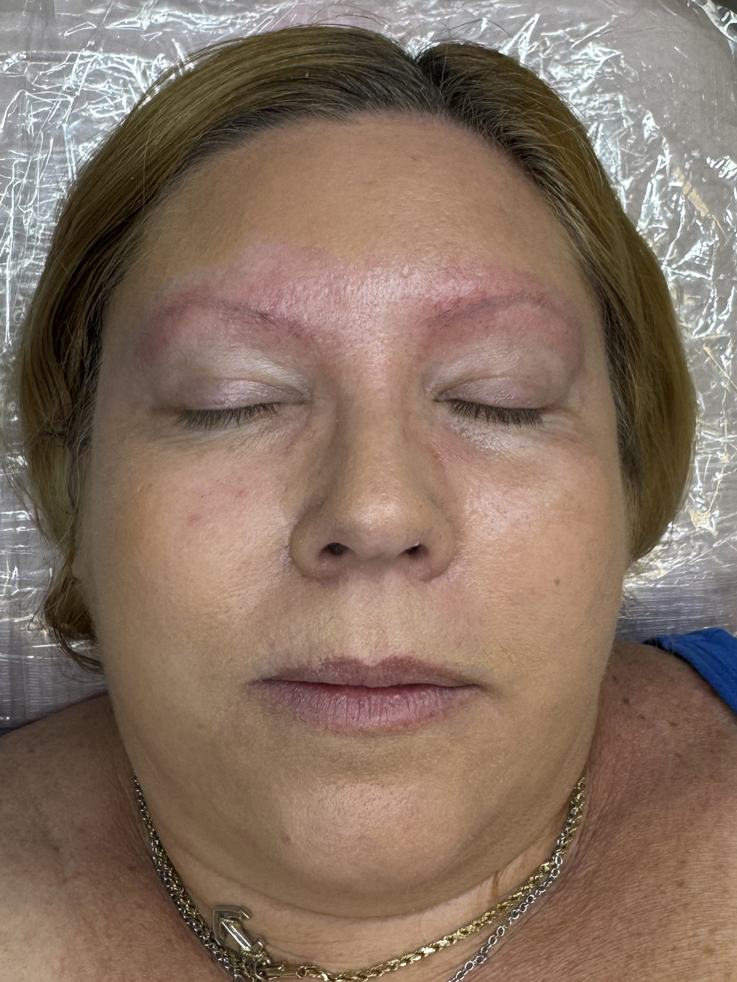 Before Image: Ombre Powder Brows - front