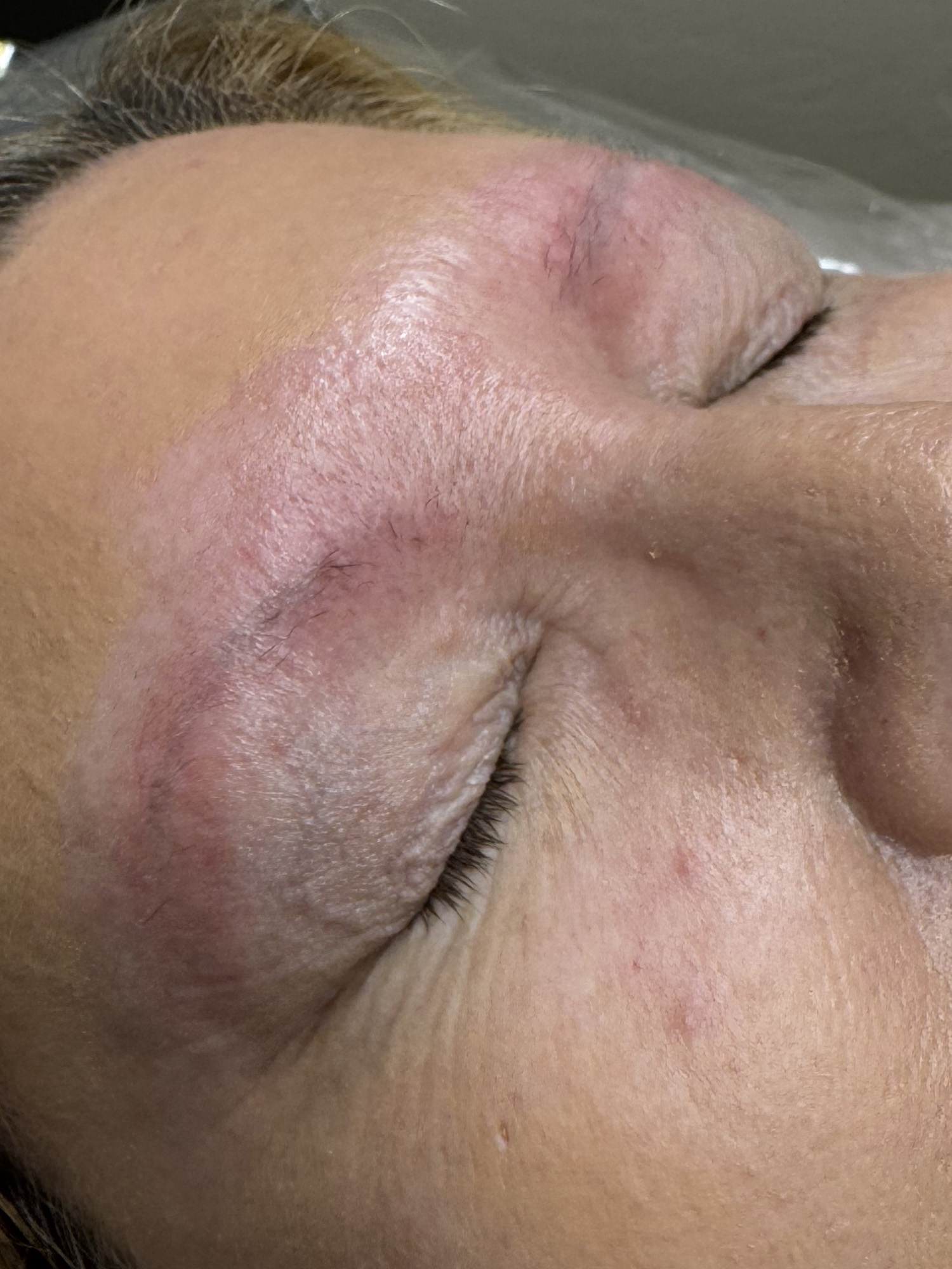 Before Image: Ombre Powder Brows - right-front-oblique